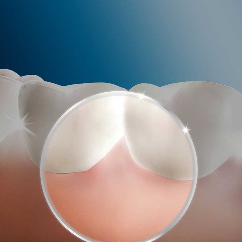 Braun Oral-B Reinigungssystem Waterjet Munddusche mit vier Waterjet Ersatzdüsen (2. Wahl)